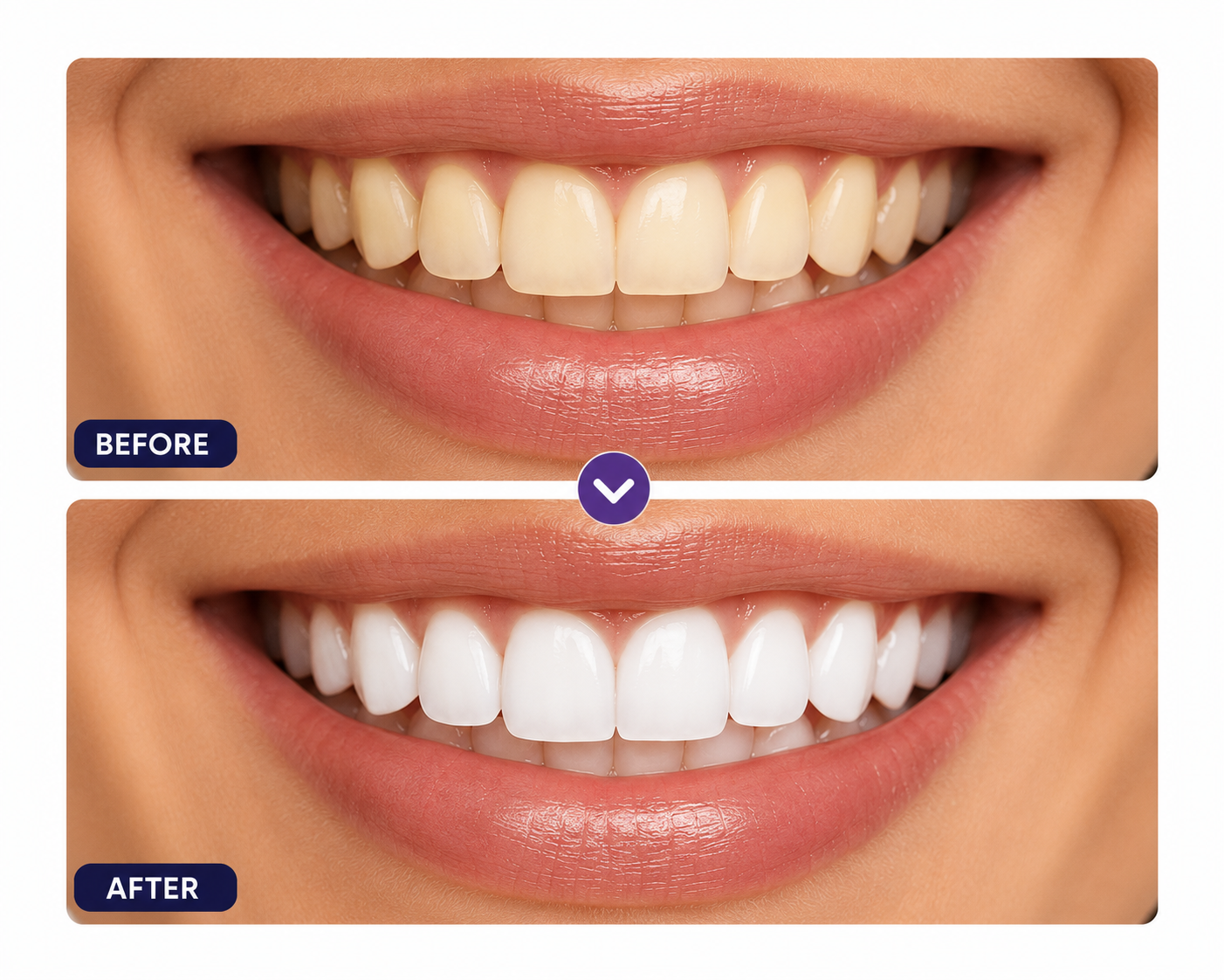 V34 Colour Corrector Strips (12-Strip)